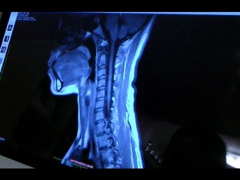 MRI RESULTS! VLOG January 28, 2013